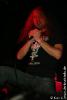Severe-Torture21